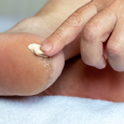 Miracle Foot Care Cream – Aloe